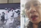 Viral Baliho Caleg Ambruk lalu Timpa Pengendara Motor, Korban Alami Luka