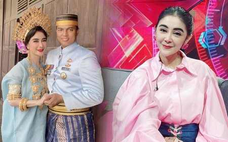 Jadi Istri Perwira Polisi, Biaya Perawatan Uut Permatasari Bikin Melongo