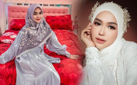 Ria Ricis Diledek 'Janda Caper', Gegara Pisah dari Teuku Ryan Sebut Ingin Operasi Kantung Mata