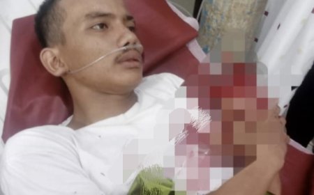Pembacokan Brutal Tiga Pelajar SMA Dwi Tunggal Tanjung Morawa, Tangan Satu Korban Nyaris Putus