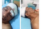 Diminta Netral, Oknum Perangkat Desa Nagori Pokkan Baru Diduga Aniaya Warga