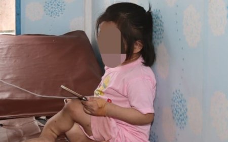 Bocah 10 Tahun di Nias Selatan Diduga Dianiaya, Polisi Tunggu Hasil Visum
