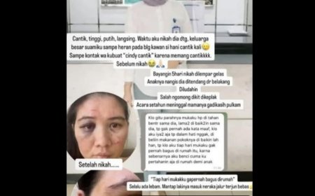 Kapolres Palas: Setiap Laporan akan Diproses, Apalagi Kasus KDRT