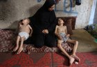 PM Australia Sebut Bantahan Israel Soal Kelaparan di Gaza Tak Masuk Akal
