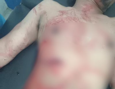 Gegara Tidak Dikasih Uang Rokok, Warga Sipirok Ditusuk Orang Tidak Dikenal
