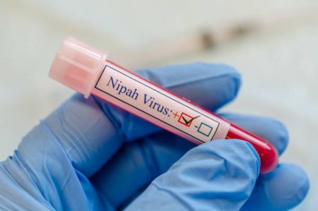 Waspada Virus Nipah di Sumut, Dinkes Perkuat Sistem Deteksi Dini
