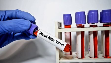 Kasus Pertama Tahun Ini, Pria 70 Tahun di Israel Meninggal Akibat Demam West Nile