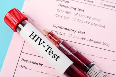 Kasus HIV di Sumut Tembus 2.334 Temuan, Kelompok LSL Dominasi Paling Tinggi